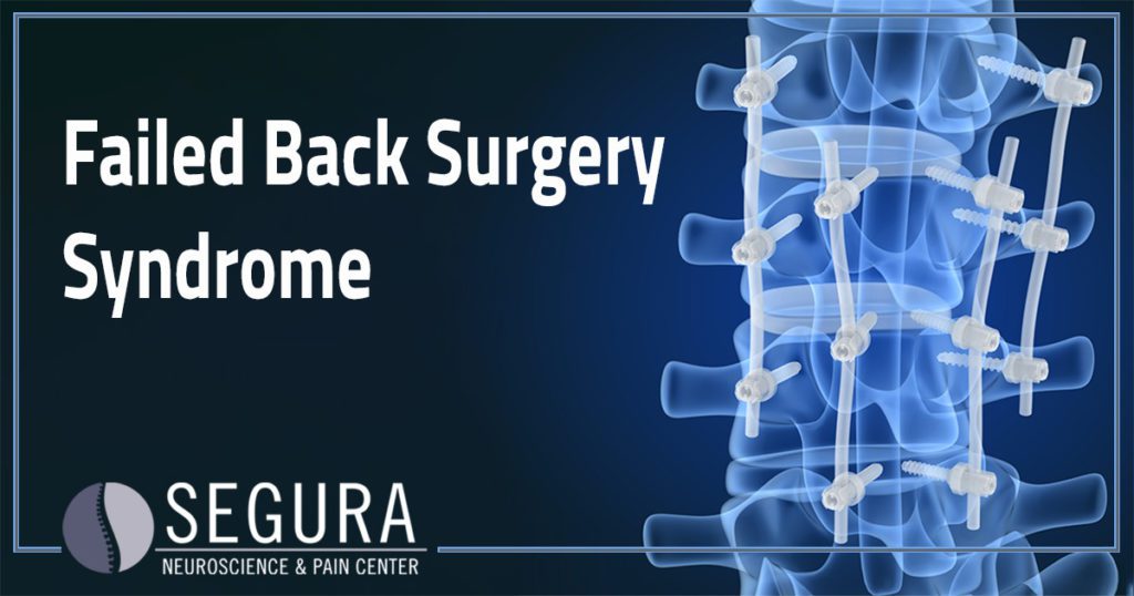 Failed Back Surgery Syndrome Segura Neuroscience Pain Center