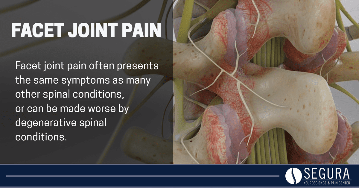 Facet Joint Pain