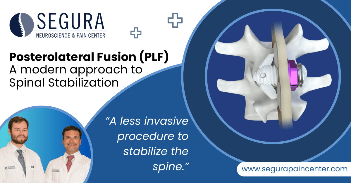 Posterolateral Fusion