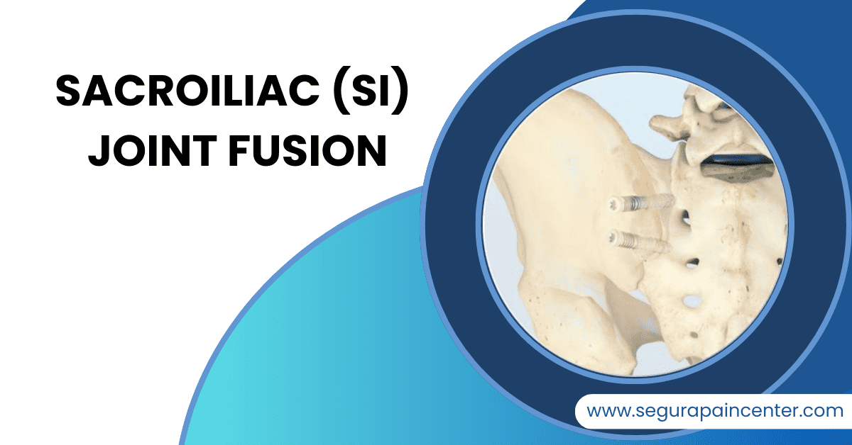 Sacroiliac (SI) Joint Fusion