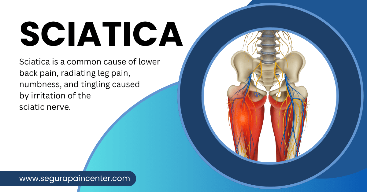 Sciatica